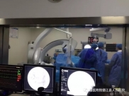 肝胆外科:德江县人民医院成功施行首例脾动脉栓塞介入术