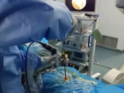 骨一科：德江县人民医院成功开展首例内镜下椎间盘摘除术
