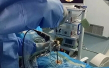 骨一科：德江縣人民醫院成功開展首例內鏡下椎間盤摘除術