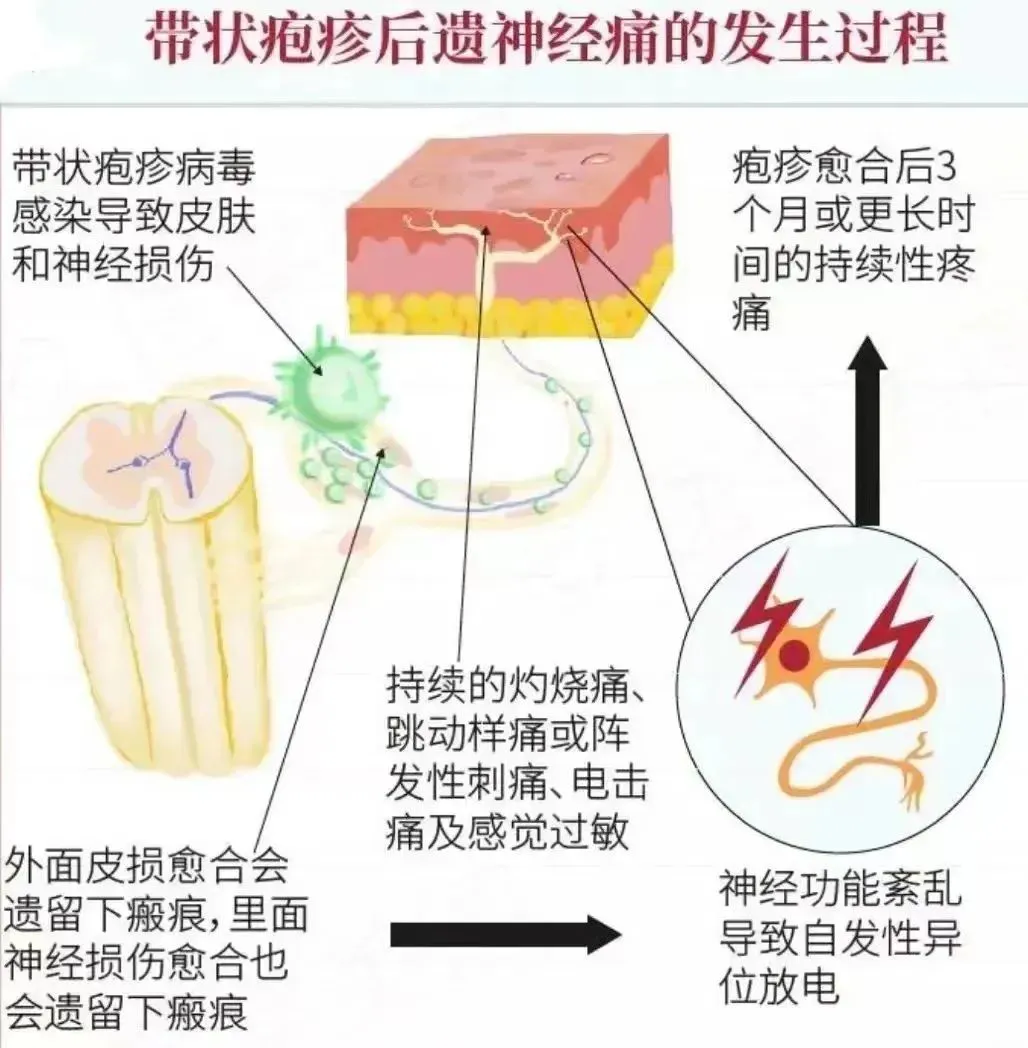 5.jpg 图片