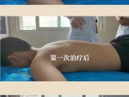 父母看呆：中医门诊“现场直播”2分钟扶正孩子脊柱侧弯！