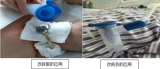 改善护理服务行动｜ICU自主呼吸气切患者迎来改良式雾化新方案