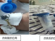 改善护理服务行动｜ICU自主呼吸气切患者迎来改良式雾化新方案