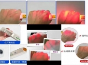 小设备解决大痛点 肾内科静脉显像仪开启“一针准”护理新模式